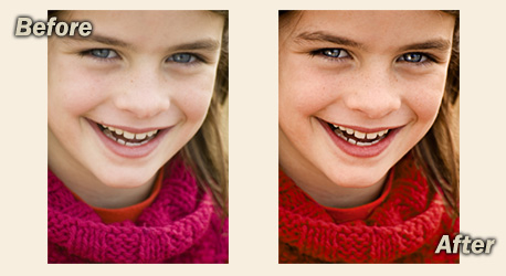 Before and After